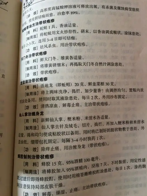 带状疱疹治疗方法