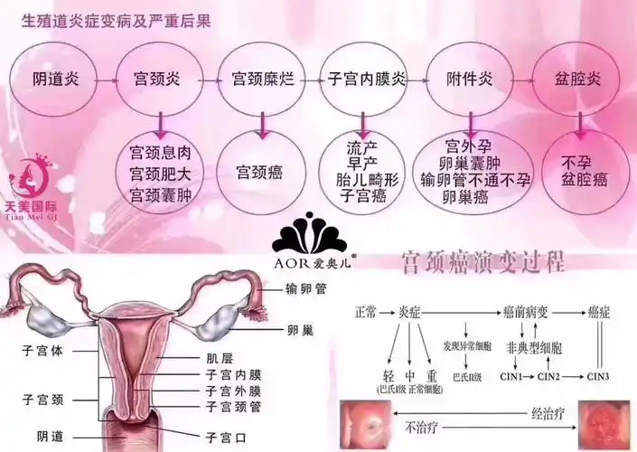 女性宫颈癌的早期表现是什么?都有哪些症状?