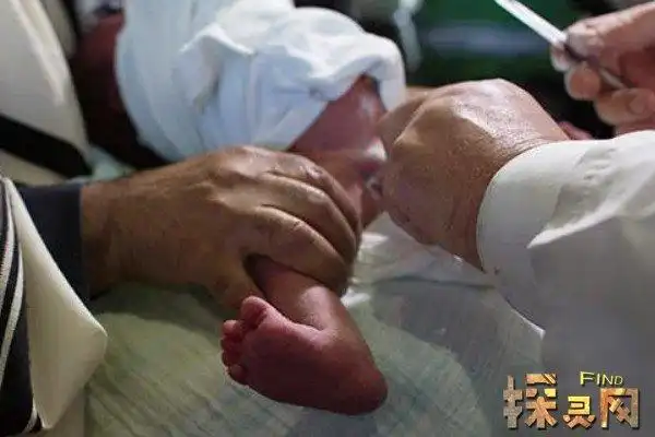 割礼仪式是一种民族或宗教习俗,分为男性割礼和女性割礼两种.