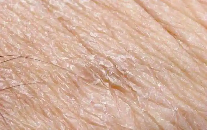 浮粉卡粉和干纹具体都是什么样子的