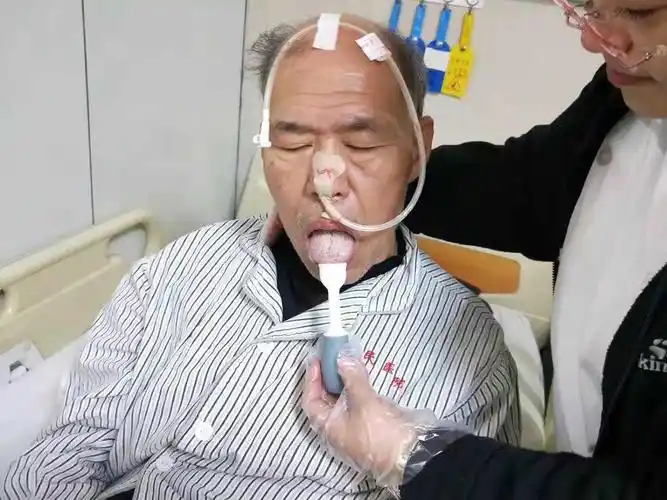 脑卒中患者吞咽障碍的多种治疗方法