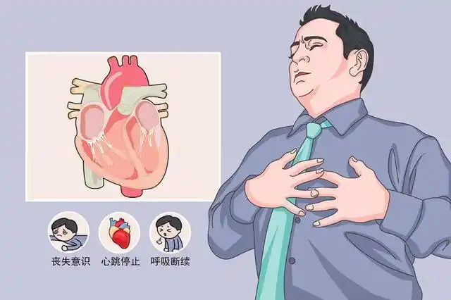 心脏骤停的原因(口诀)