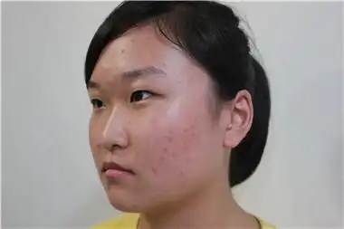 侧面看,鼻子真的好塌啊,而且我的鼻孔!怎么可以长成这样?