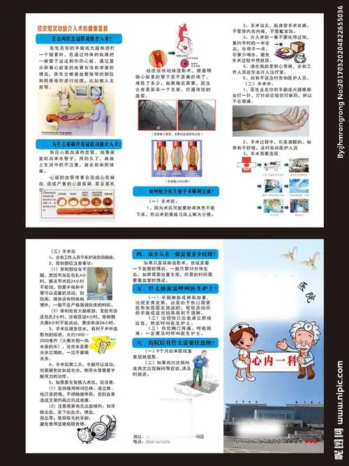 经皮冠状动脉介入术 医院彩页图片
