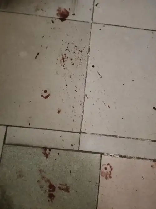 讨论后续外伤有图慎入一觉醒醒来楼梯地板有血