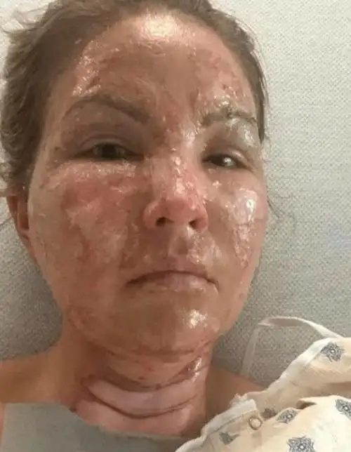 酒精_美国_事故