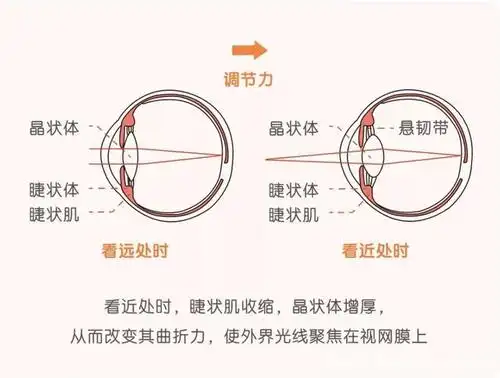 小朋友们从幼儿园就要开始防控近视啦