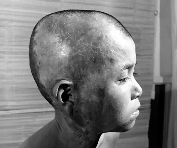 实拍原子弹爆炸后广岛