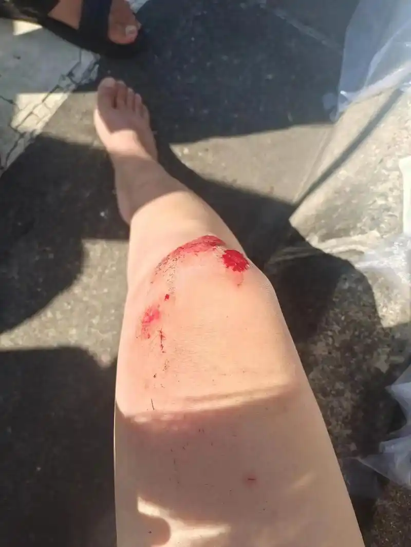 在三桥骑车摔了.今天上午10点左右,我载着二娃骑电瓶车途径三 - 抖音