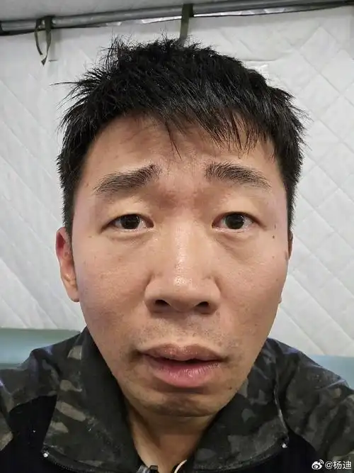 杨迪晒素颜照##杨迪上岛后变沧桑了