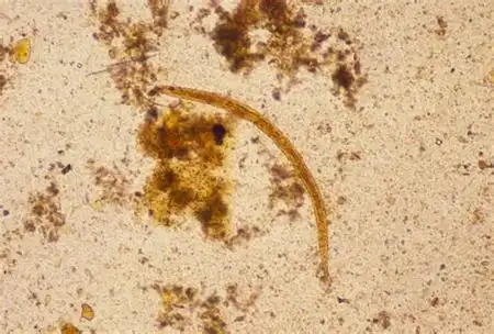 蛲虫图片(蛲虫图片及虫卵图片)-玛卡通