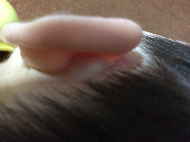 [绍兴妈妈帮]八个月时发现宝宝的耳后长了囊肿.