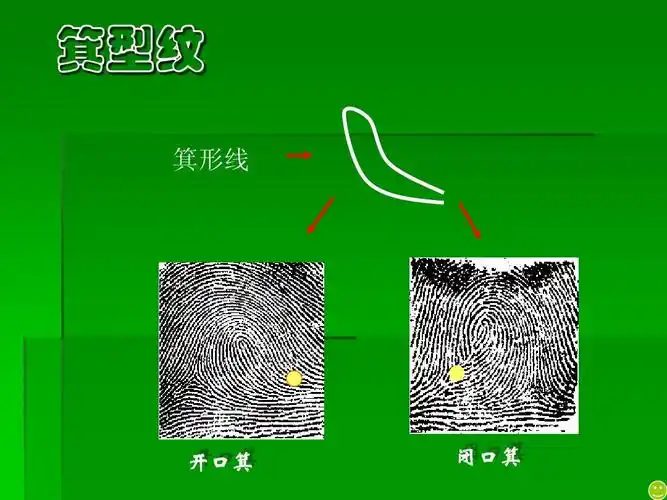 箕型纹 箕形线 开口箕 闭口箕