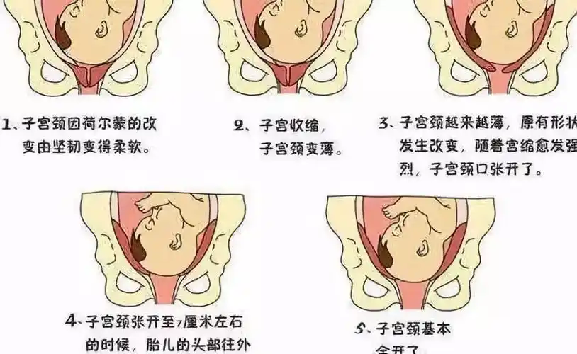 孕期知识你知道吗分娩时胎儿是这样从产道出生的