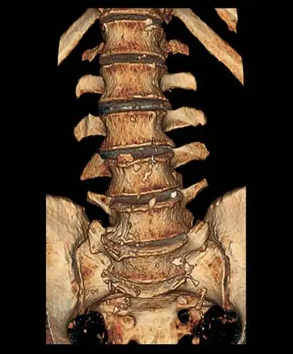 合成图,医疗,医学,人物