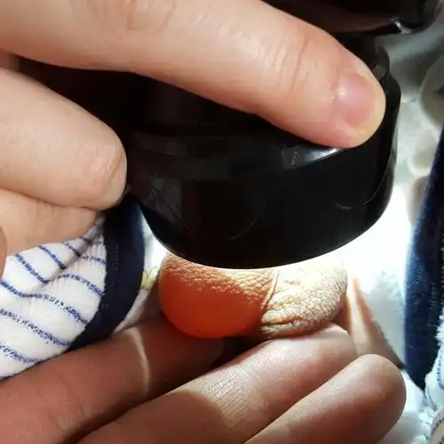 一个多月婴儿睾丸一个大一个小,现在需要到医院治疗吗?