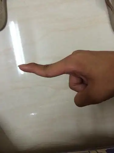 手指伸不直,怎么样才能恢复