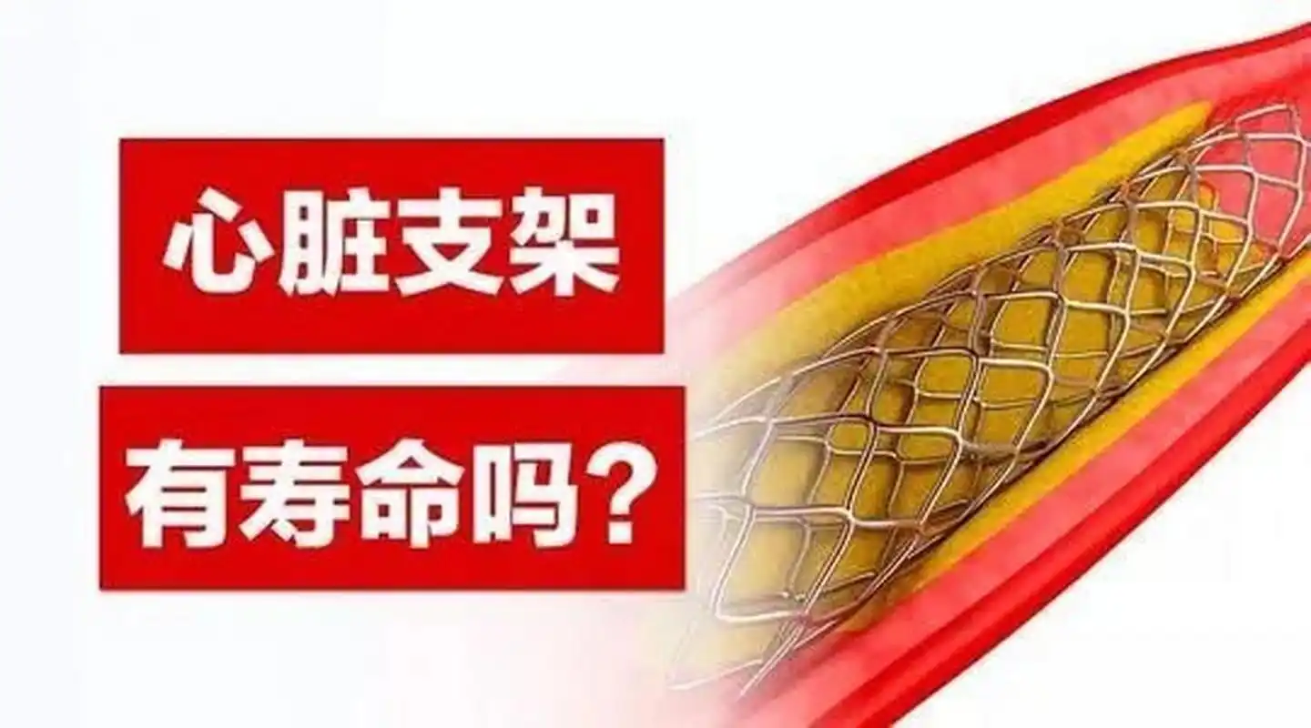 在门诊上经常有人问,支架的寿命有多长?