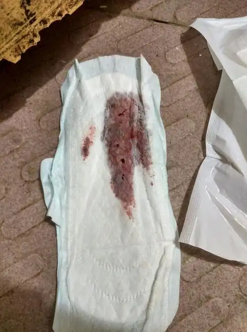 月经量这样正常吗?如图这是一次换的纸一天换三四次吧!