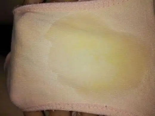 各位宝妈又出过水样分泌物吗