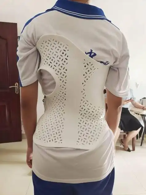 🚫脊柱倾斜侧弯支具,你真的了解吗?