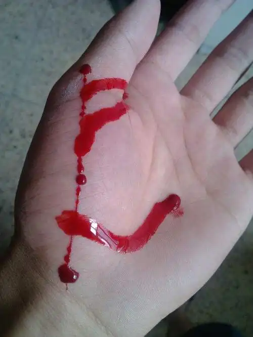 不小心受伤"流血"如何正确应对