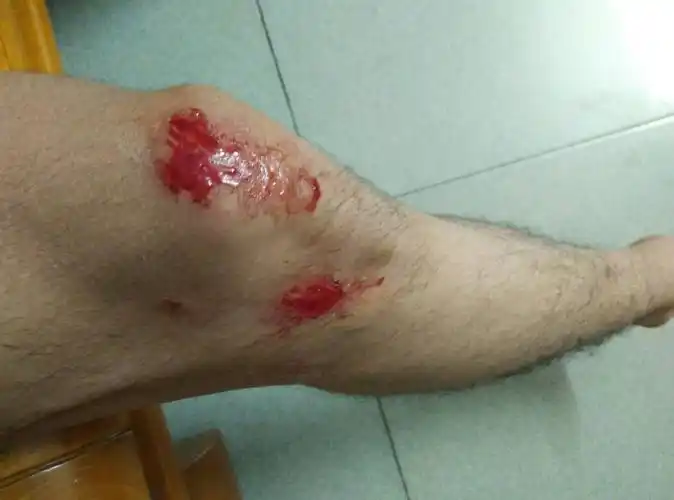 刚洗完澡不过没湿,刚刚骑单车不注意 摔进去了一个水潭里,男15水.