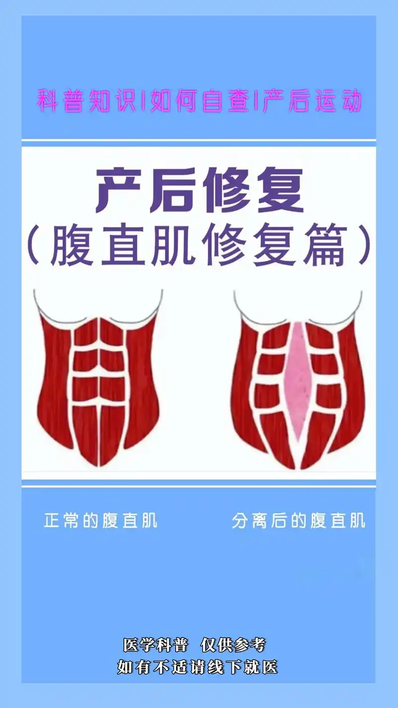 如何知道自己是不是腹直肌分离呢?#腹直肌分 - 抖音