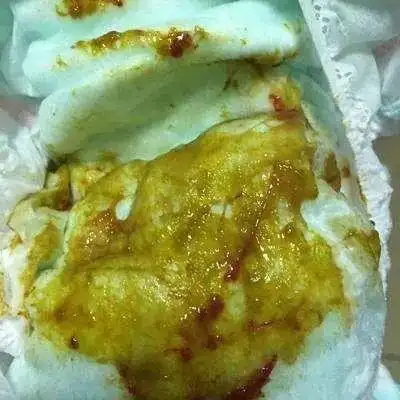 大便里真的有血注:这是吃香蕉后的纤维丝注:这是火龙果籽有些孩子大便