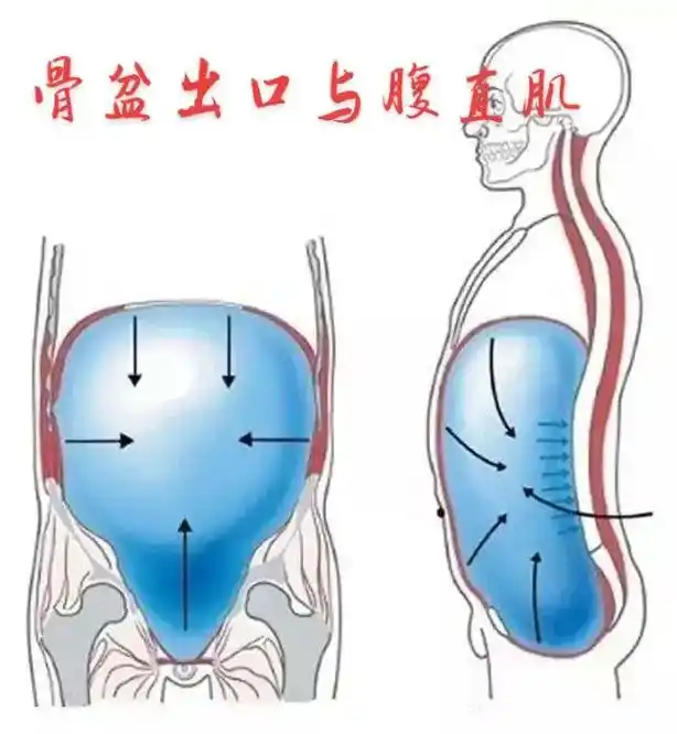 骨盆出口与腹直肌分离