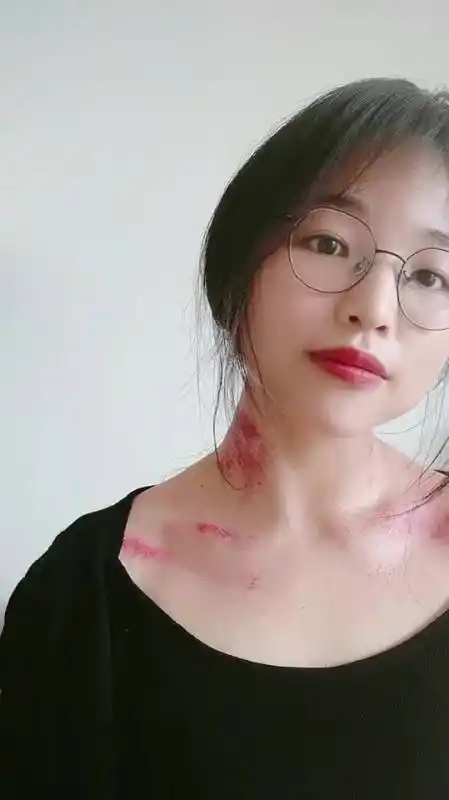 颈部刮痧美颈淡化颈纹改善面部气色!