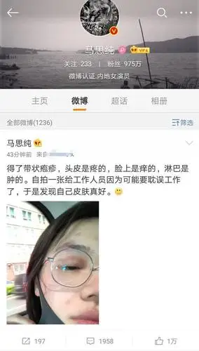 马思纯患带状疱疹眼皮发红还拍照自黑马思纯为什么得带状疱疹