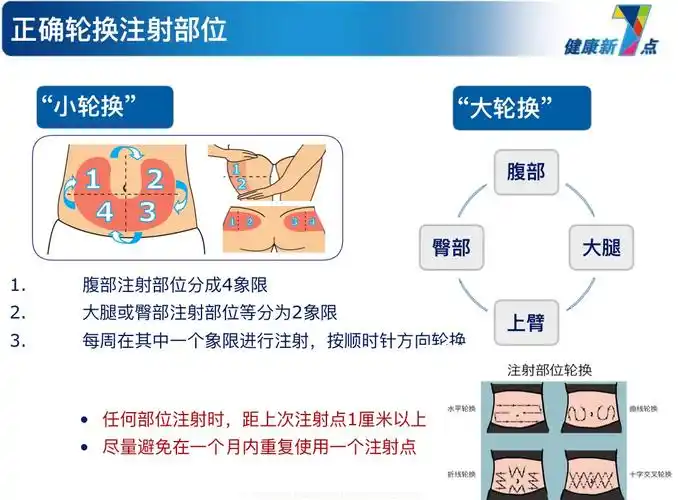 胰岛素笔的正确注射方法