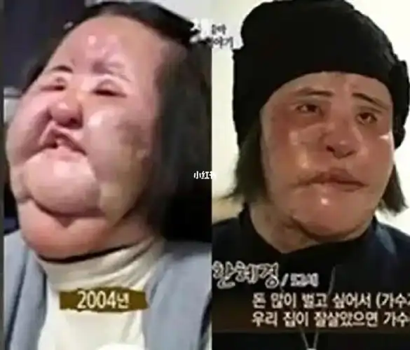 韩国明星韩慧景整容失败事业一落千丈