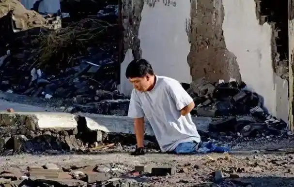 我国首个核辐射受害者,四肢溃烂全切后体重只剩50斤,现在怎样了