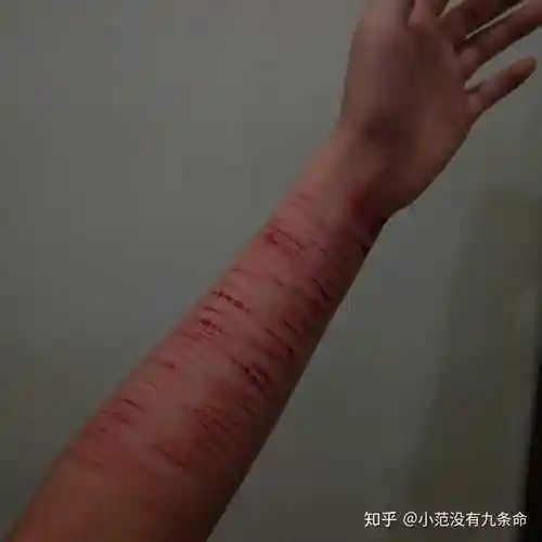 今晚自残图片 慎点!