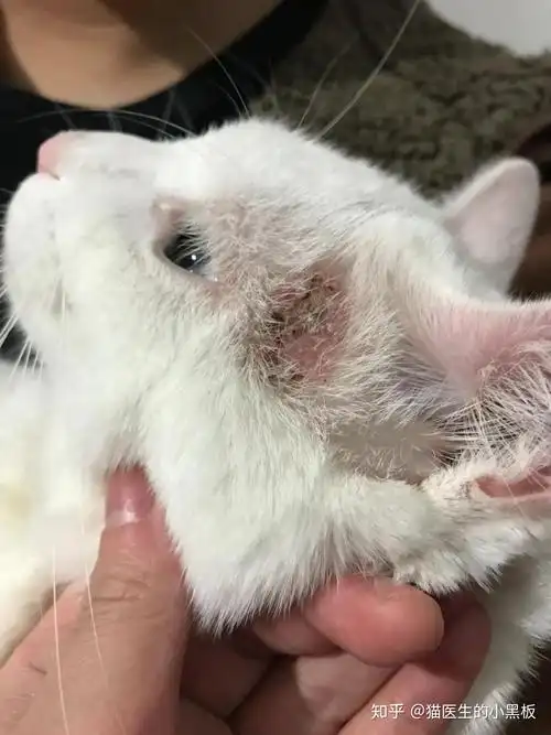 环境污染的程度,以及接触者或动物的年龄,是癣感染发生的一个重要因素