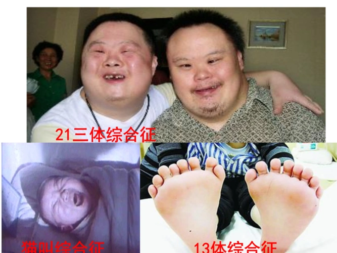 第2节染色体变异(定稿)详解.ppt