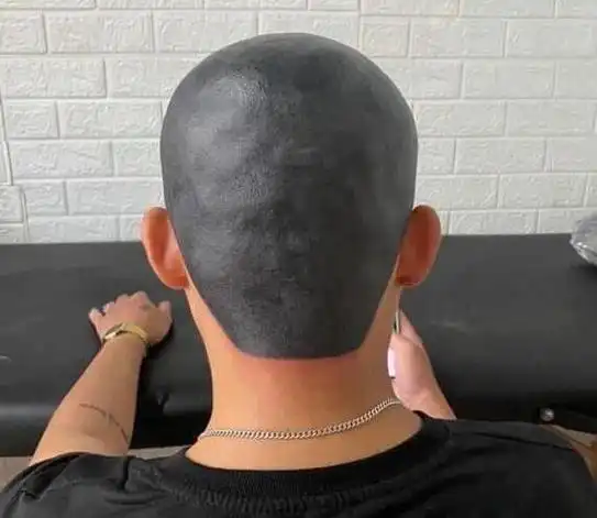 男子剃光头后怕被妻子发现竟把头皮纹成黑色结果悲剧了
