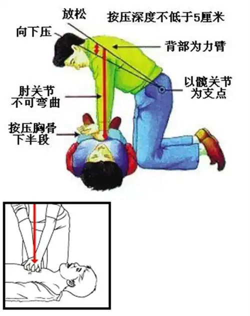 【急救】心肌梗死的抢救——胸外心脏按压