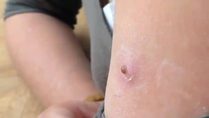 看完保证你不再"躺平"!_尸体_寄生_老人