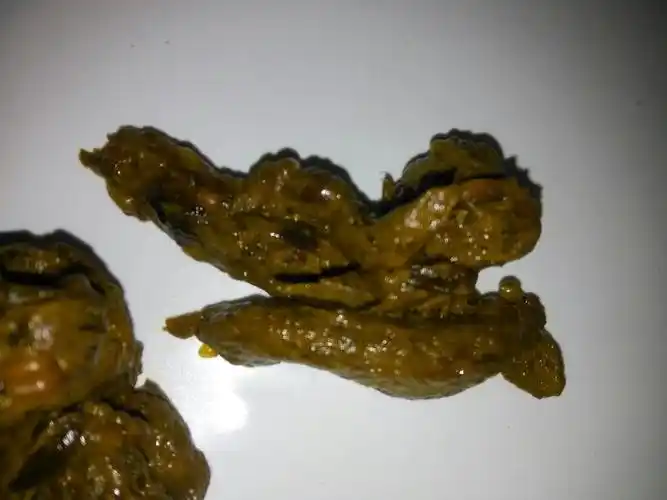 这样大便正常吗