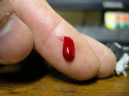 手指流血图片52