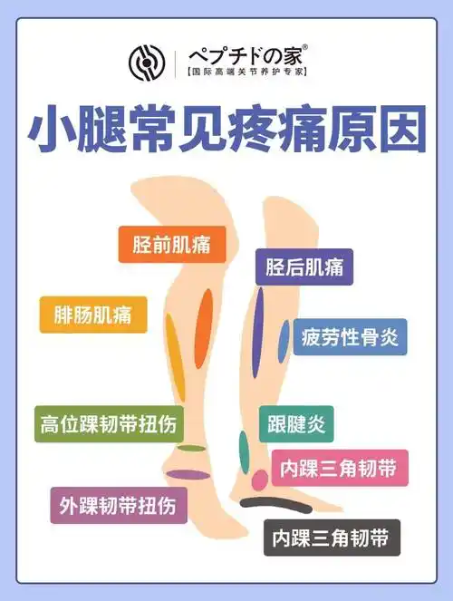 一张图告诉你小腿常见疼痛原因(下)