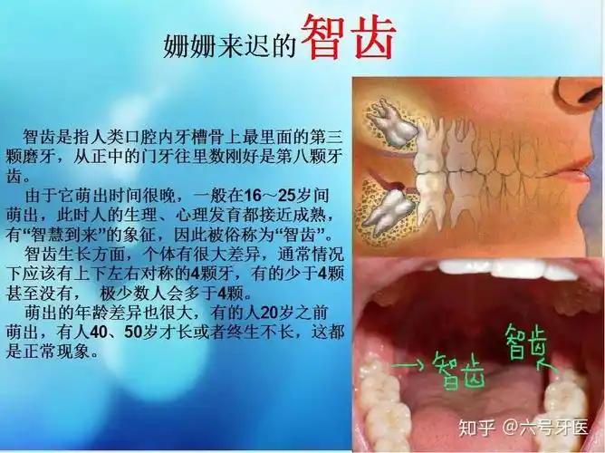 智齿到底是几岁长才正常? - 知乎