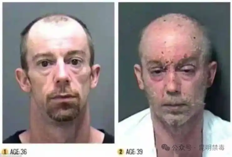 吸毒前后对比图堪称毁容胆小慎入