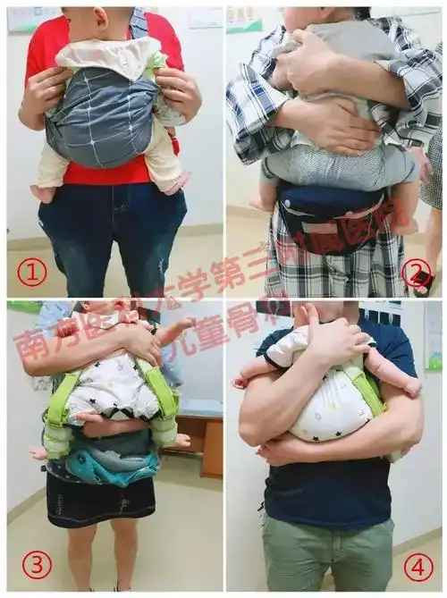 婴儿髋关节不对称图片(宝宝臀纹不对称妈妈不上心) - 赤虎壹号