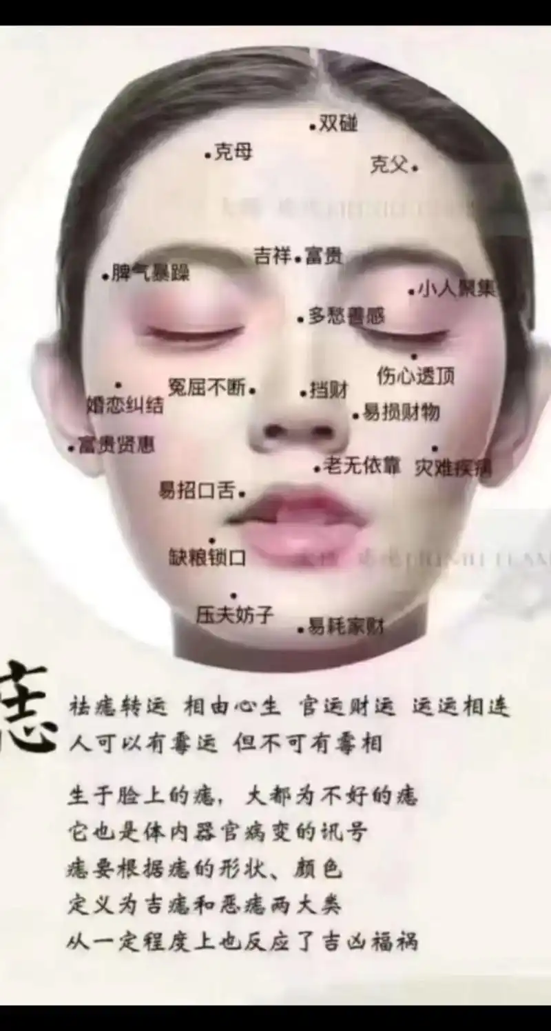 ㊙️痣解说: 鼻有头痣,破正财 鼻有翼痣,破偏财 眼有袋痣,克子女