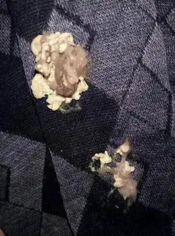 有些人在排便的时候发现大便颜色是黑色的,总感觉这种颜色不太正常.