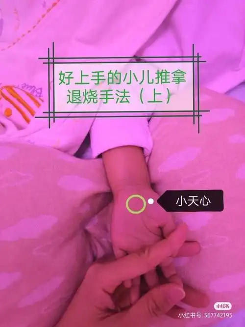 小儿发烧推拿